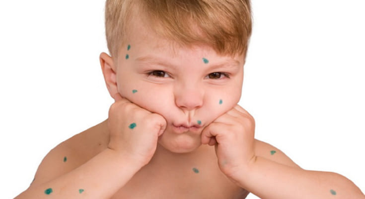 lam cach nao de phan biet zona than kinh va thuy dau3