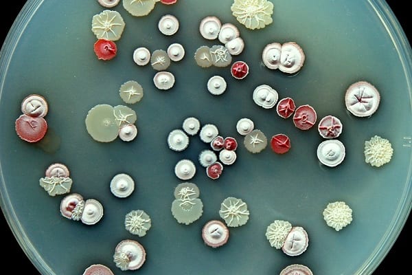 Phân loại xạ khuẩn 1 phanloaixakhuan