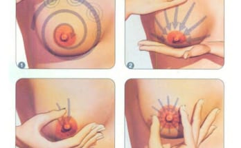 Phân biệt Cương sữa và Tắc tia sữa 1 cương sữa và tắc tia sữa
